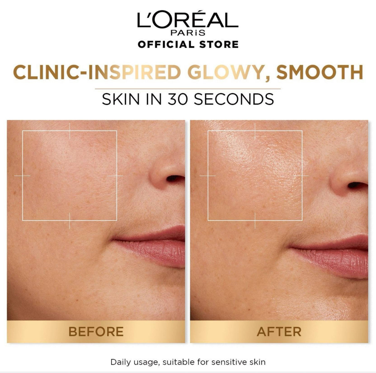 L'ORÉAL PARIS Glycolic Bright 5% Glycolic Acid Peeling Toner - -