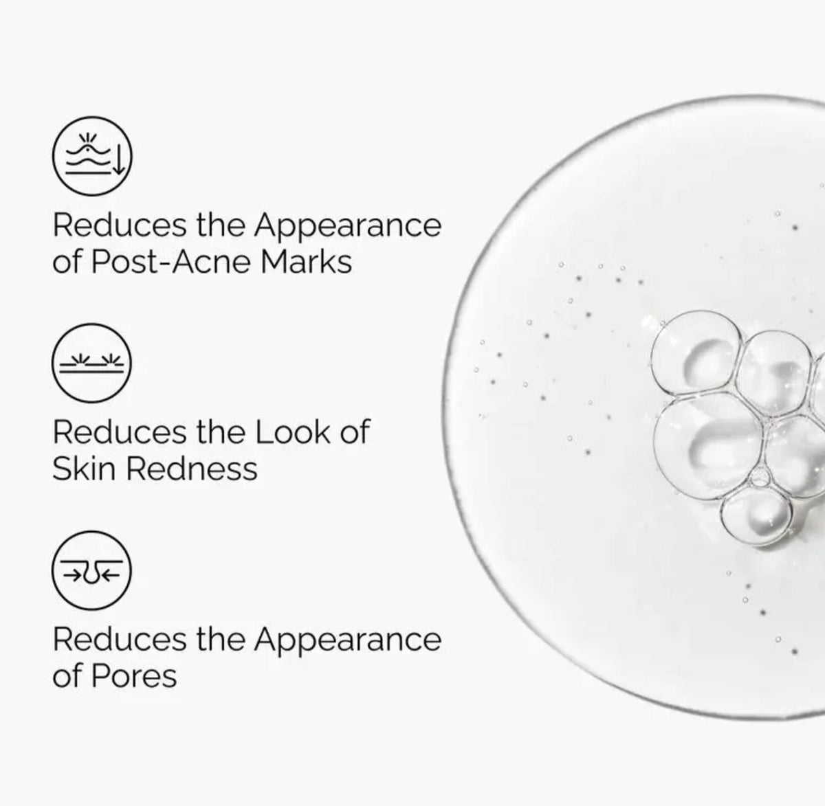 The Ordinary Aloe 2% + NAG 2% Solution 30ml - -