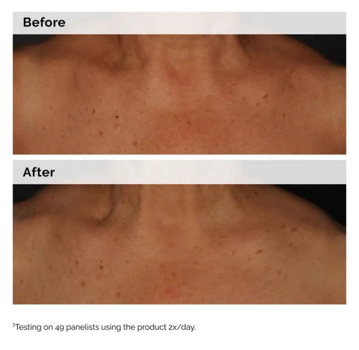 The Ordinary Niacinamide 5% Face and Body Emulsion - -