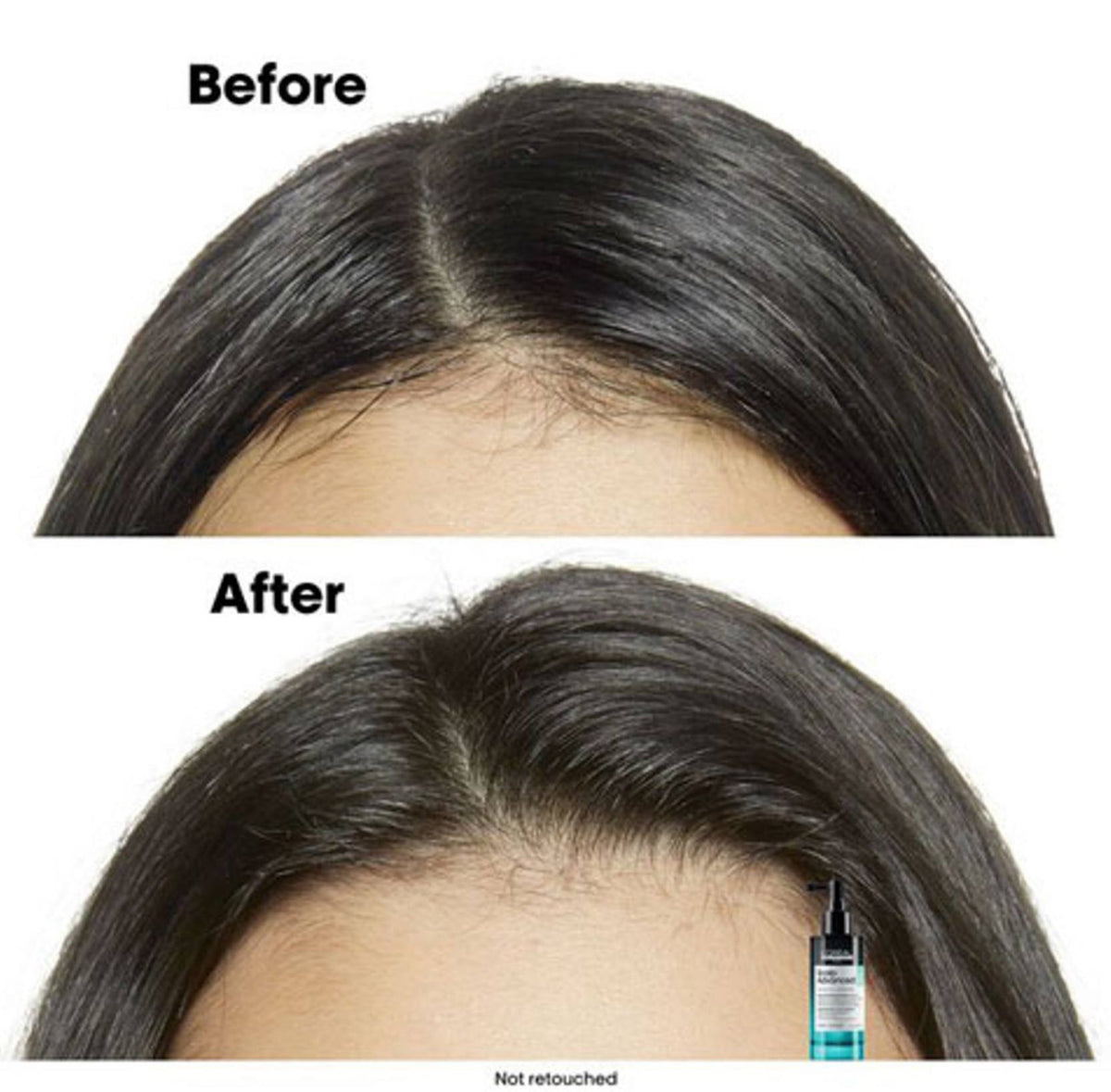 L'ORÉAL PARIS Scalp Advanced Professional 5-in-1 Serum - -