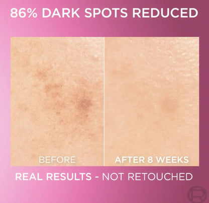 L'ORÉAL PARIS Glycolic Bright with 8% Face Serum for Dark Spots & Brightening - -