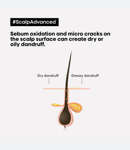 L'ORÉAL PARIS Serie Expert Scalp Advanced Anti-Discomfort Dermo-Regulator Shampoo - -