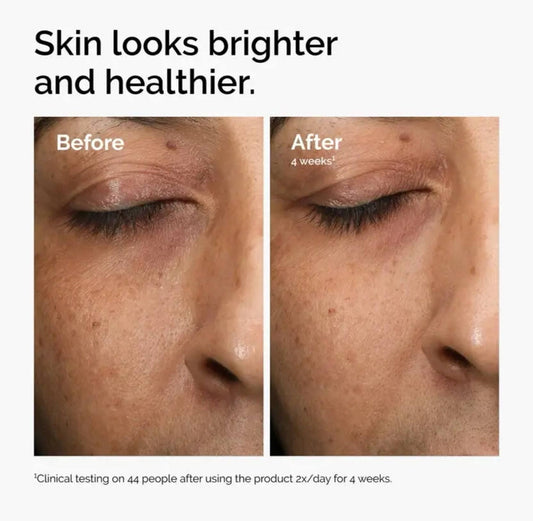 The Ordinary Multi-Antioxidant Radiance Serum - -