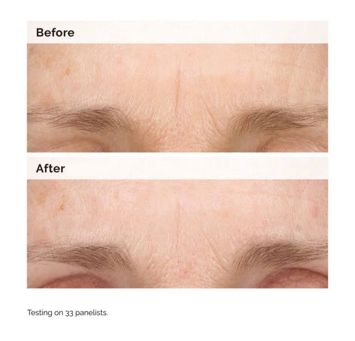 The Ordinary Retinal 0.2% Emulsion - -