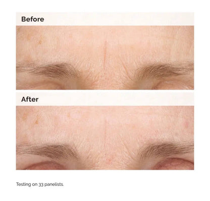 The Ordinary Retinal 0.2% Emulsion - -